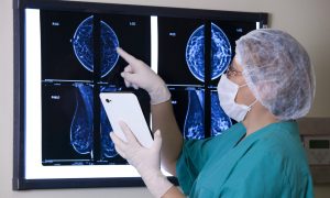 Mammográfia (Fotó: Getty Images)