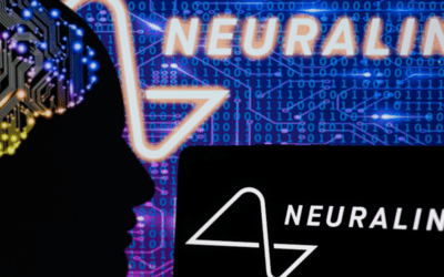 Emberi gondolat vezérelheti a számítógépet vagy a sérült végtagot Elon Musk cége beépítette az első vezeték nélküli chipet emberi agyba – Megkérdeztük a Neuralink volt munkatársát