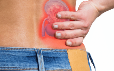 Mikroméretű robotokkal semmisítik meg a vesekövet