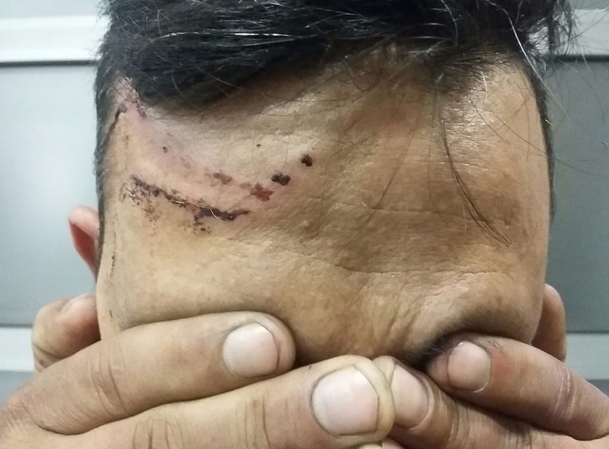 <span class="entry-title-primary">Tovább gyűrűzik a kutyaharapás-ügy</span> <span class="entry-subtitle">Egyre erőszakosabb, kegyetlenebb és megalázóbb bánásmódban volt részük a menekülteknek</span>