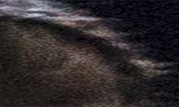 <span class="entry-title-primary">(L)ék</span> <span class="entry-subtitle">Gulisio Tímea verse</span>