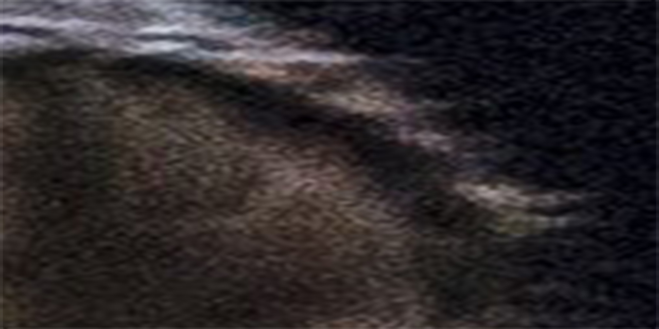 <span class="entry-title-primary">(L)ék</span> <span class="entry-subtitle">Gulisio Tímea verse</span>