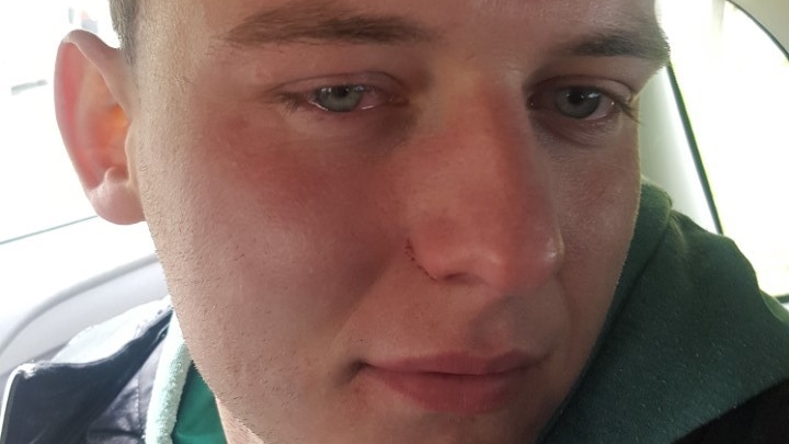 Verbász: Összevertek két SZSZP-aktivistát