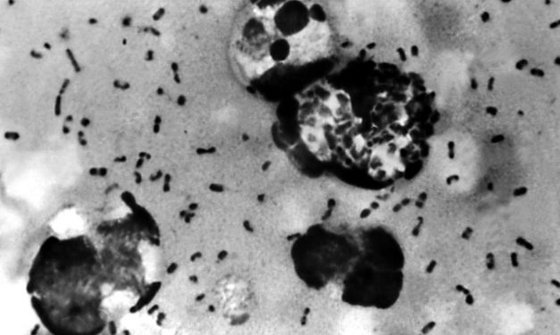 Pestist diagnosztizáltak egy gyermeknél az Egyesült Államokban