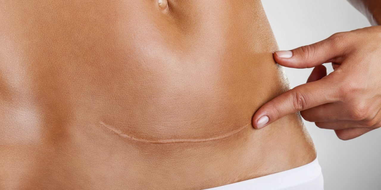 <span class="entry-title-primary">Kétszeresére nőtt a császármetszések száma</span> <span class="entry-subtitle">Szerbiában majdnem minden második gyermek műtéti úton jön a világra</span>