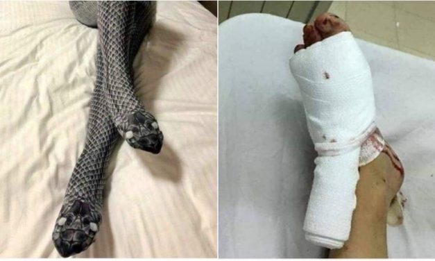 Meg akarta lepni a férjét az új harisnyával, de az cserébe eltörte a lábát