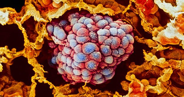 Izraeli gyógyszercég: Egy éven belül gyógyítható lesz a rák