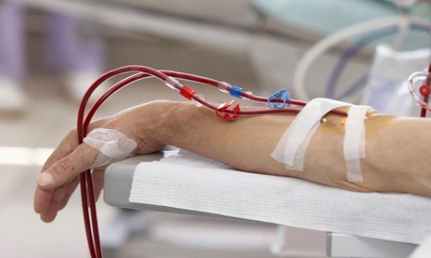 Vajdaságban 170 beteg vár veseátütetésre