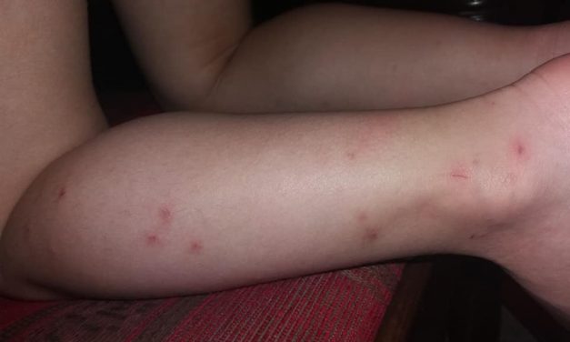 A zentai szúnyogirtás annyit ért, mint halottnak a napszemüveg