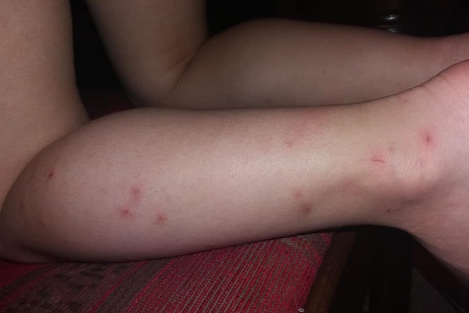 A zentai szúnyogirtás annyit ért, mint halottnak a napszemüveg