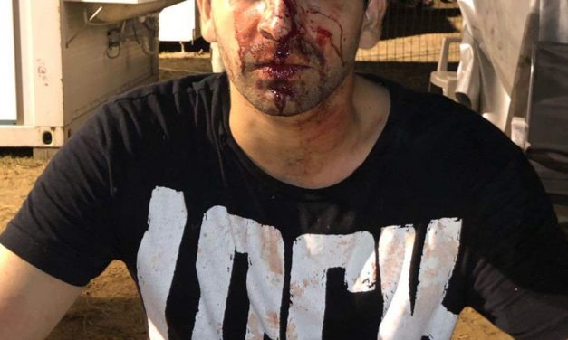 Köcsög külföldinek neveztek és összevertek négy fiatalt a Balaton Soundon