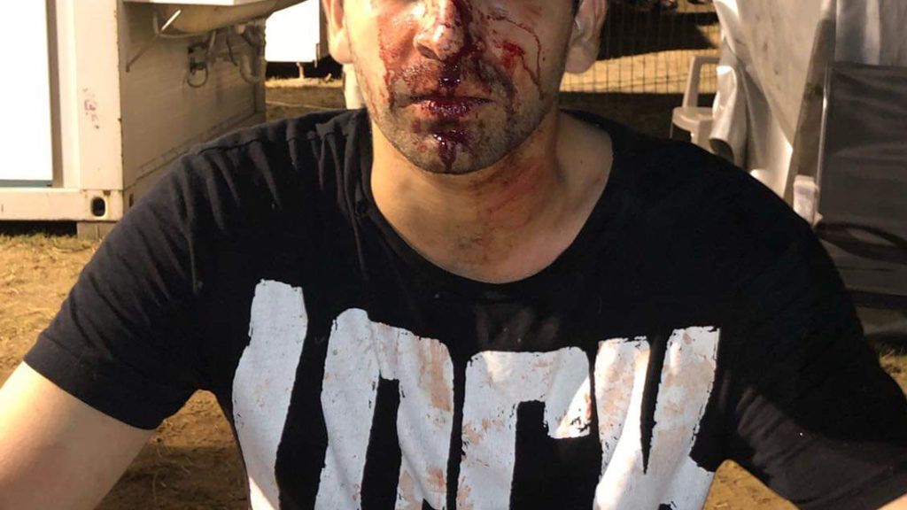 Köcsög külföldinek neveztek és összevertek négy fiatalt a Balaton Soundon