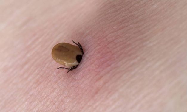 Új eljárás segíthet kimutatni a Lyme-kórt