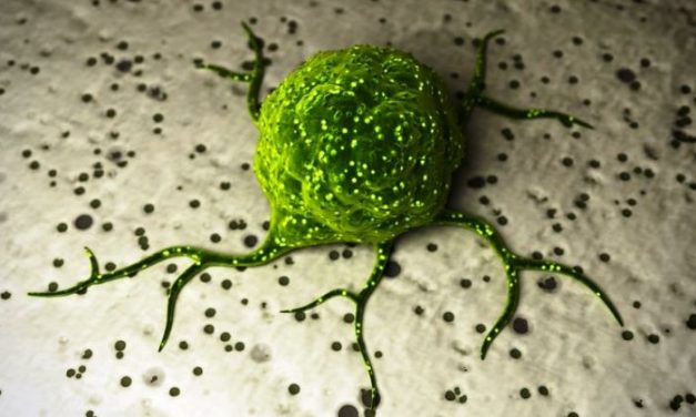 <span class="entry-title-primary">Tumor, miért vagy te nekem?</span> <span class="entry-subtitle">Én és a Hodgkin-limfóma (1. rész)</span>