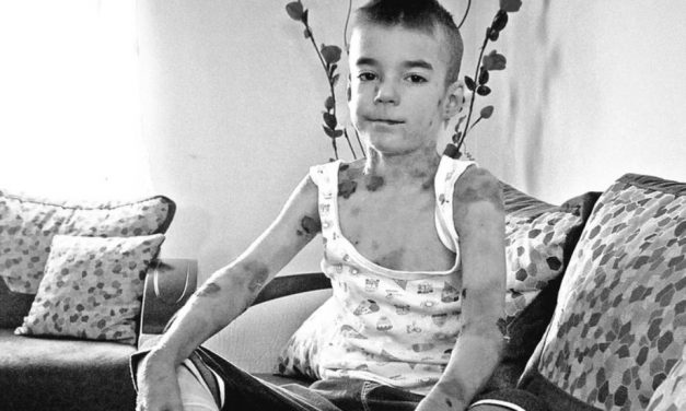 Szerbia gyászol: Elhunyt a pillangógyerek