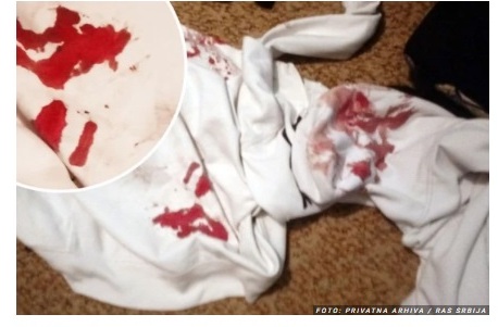 Szabadka: Azonosították Sz. Á. hat támadóját, akik súlyosan bántalmazták a tizenhét éves fiút