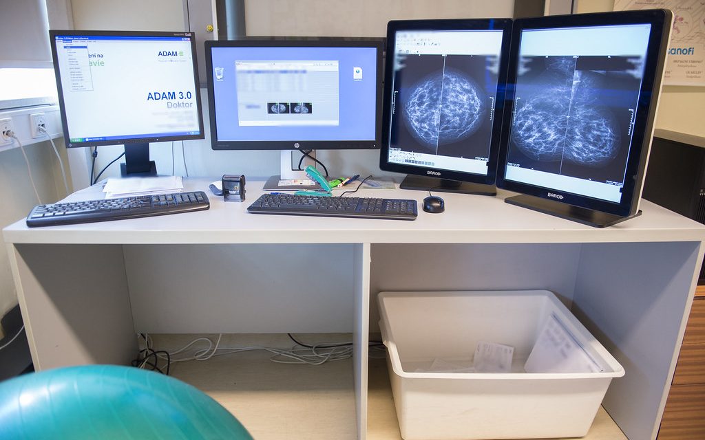 A mesterséges intelligencia biztosabban ismeri fel a mellrákot, mint az orvosok