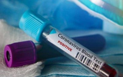 Továbbra is sok az újonnan megfertőződött koronavírusos Magyarországon