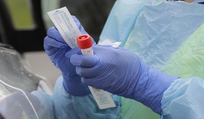 Elkészült az első magyar fejlesztésű Covid-teszt