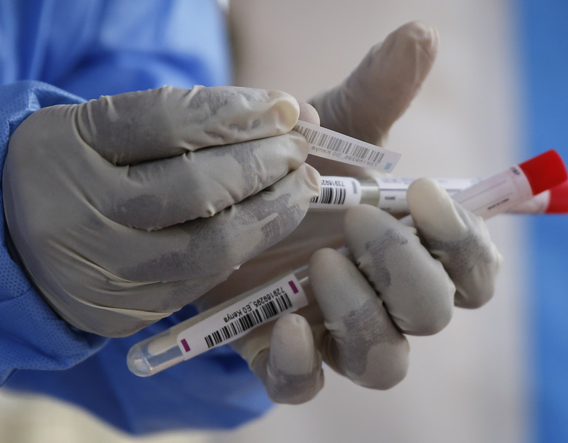 A vércsoport befolyásolhatja a COVID-19 súlyosságát