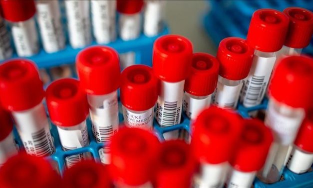 Koronavírus: Nem volt még ennyi beteg lélegeztetőgépen