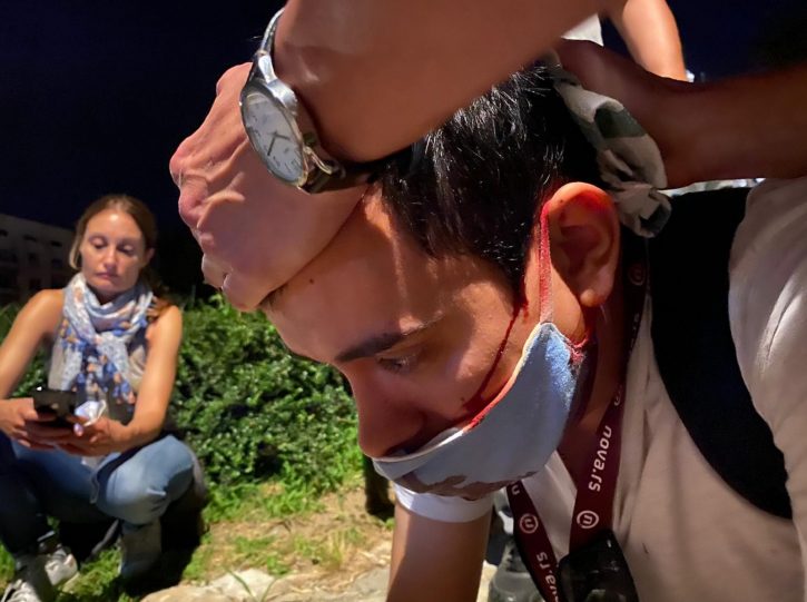 Kapucnis huligánok támadták meg a Nova.rs újságíróját