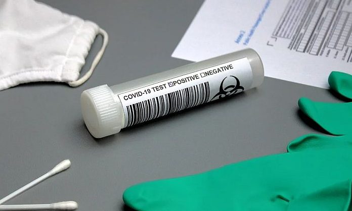 Két kínai állampolgár hamis PCR-teszttel próbálta meg átlépni a szerb-bosnyák határt