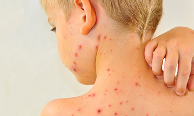 A kanyaró is terjed Szerbiában