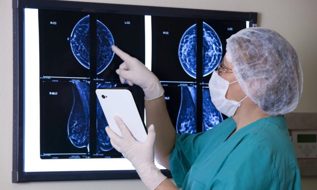 Megnőtt a mellrák műtétek száma Szerbiában