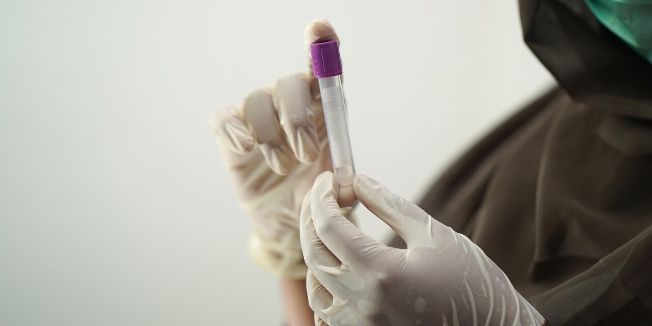 A Kreml szerint az amerikaiak oroszokra targetált biológiai fegyvert fejlesztenek Ukrajnában