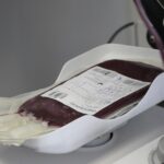 Kritikus a vérhiány: másfél napra elegendő a vérkészlet, műtéteket is elhalaszthatnak