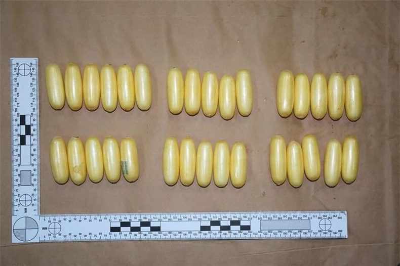 Leröntgenezték az emésztőrendszerét, a látottak sokkolták a hatóságokat