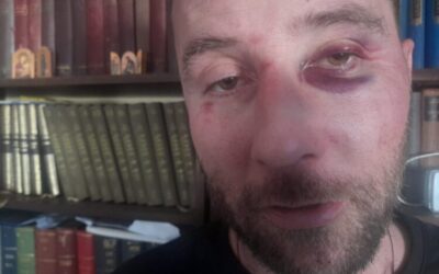 A becskereki férfi az államfőt szidalmazta, brutálisan megverték