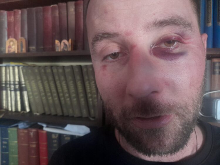 A becskereki férfi az államfőt szidalmazta, brutálisan megverték