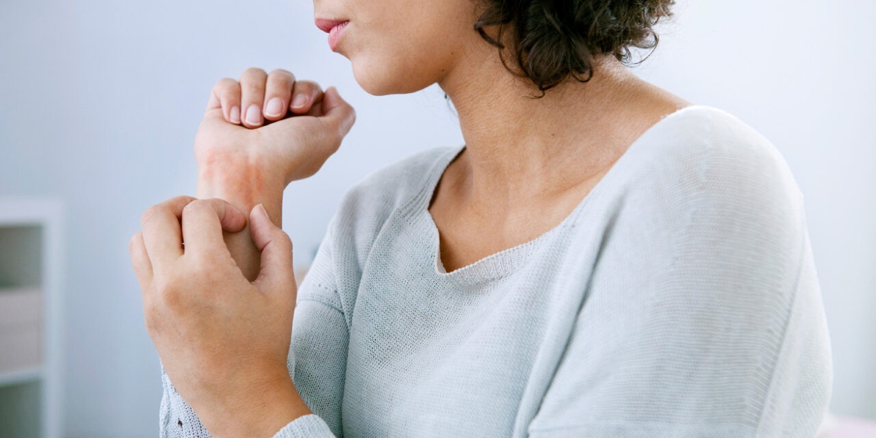 Terjed a rühesség Szerbiában?