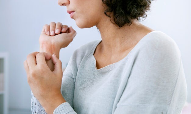 Terjed a rühesség Szerbiában?