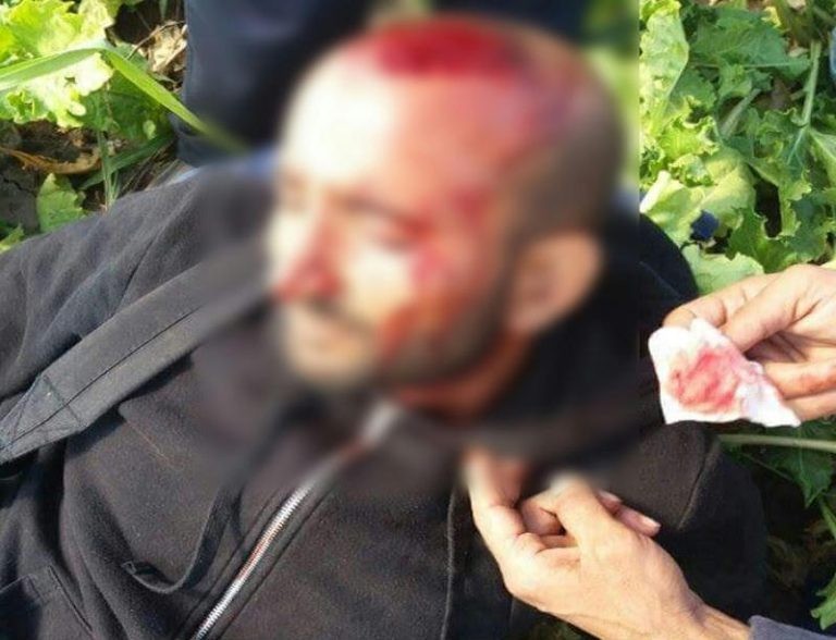 Véresre vertek a magyar rendőrök egy pakisztáni menedékkérőt