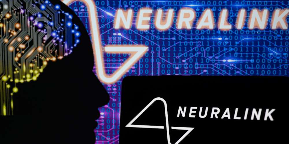 <span class="entry-title-primary">Emberi gondolat vezérelheti a számítógépet vagy a sérült végtagot</span> <span class="entry-subtitle">Elon Musk cége beépítette az első vezeték nélküli chipet emberi agyba – Megkérdeztük a Neuralink volt munkatársát</span>