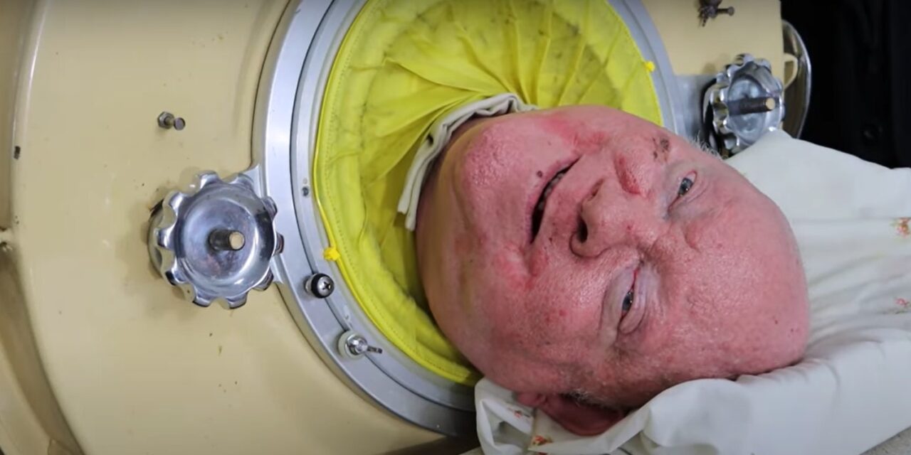 Meghalt Paul Alexander, aki több mint 70 évet élt egy vastüdőben