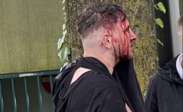 Székekkel és asztalokkal verték egymást a szerb és az albán drukkerek (Videó)