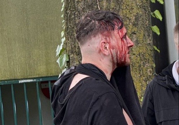 Székekkel és asztalokkal verték egymást a szerb és az albán drukkerek (Videó)