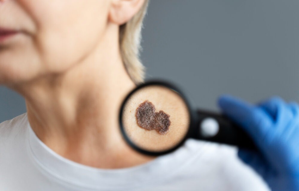 <span class="entry-title-primary">A bőrnek is van immunrendszere</span> <span class="entry-subtitle">Megnyílhat az út a bőrre kenhető védőoltások előtt</span>