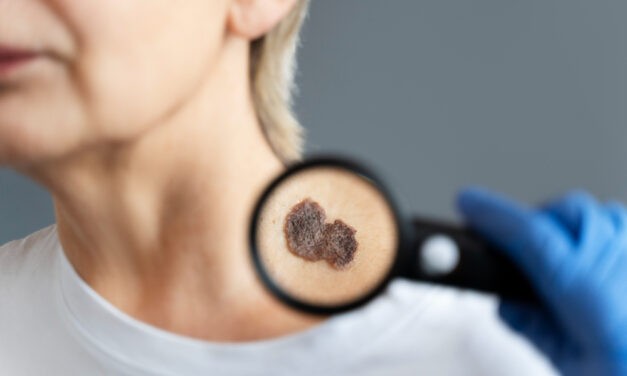 A bőrnek is van immunrendszere