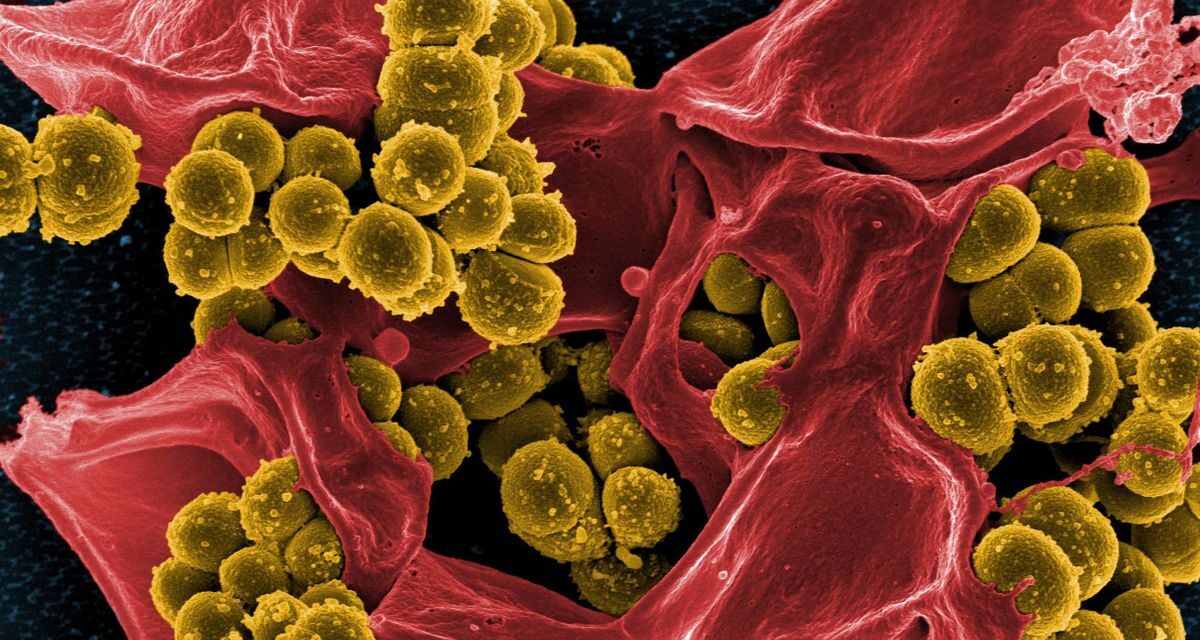 Frankenstein a Balkánon: a szuperbaktériumok már pusztítanak