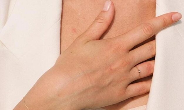 Az arany világa: mit mesél rólunk?