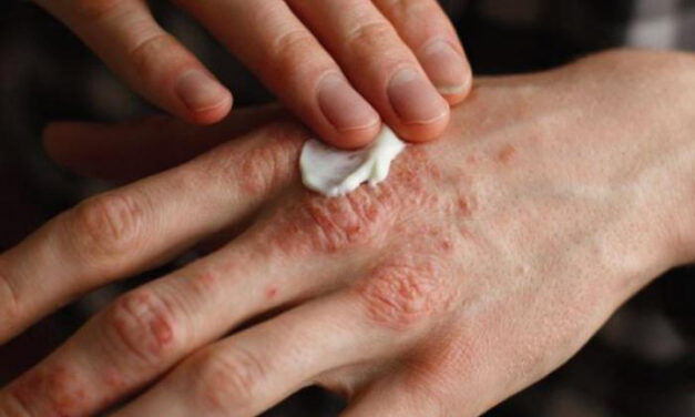 Leprás megbetegedéseket regisztráltak szomszédainknál