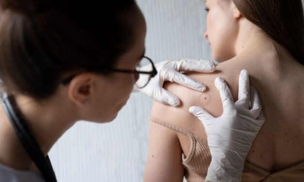 Jelentősen megnövekedett a melanóma előfordulása