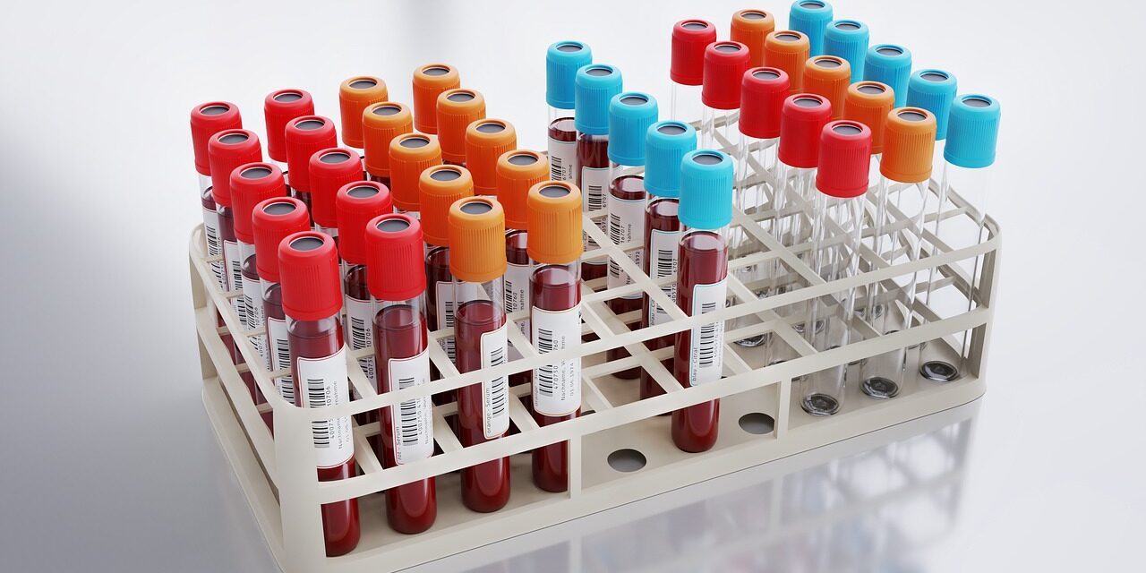 Egyszerű vérvizsgálat mutathatja ki a gyógyíthatatlan betegséget