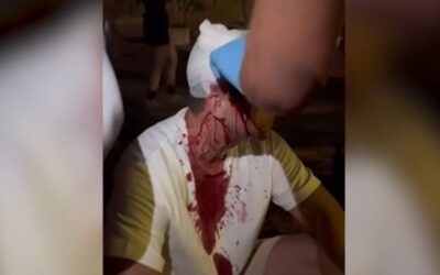 Beverték az ellenzéki képviselő fejét a haladók verőemberei