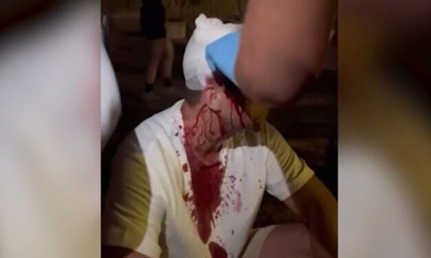 Beverték az ellenzéki képviselő fejét a haladók verőemberei